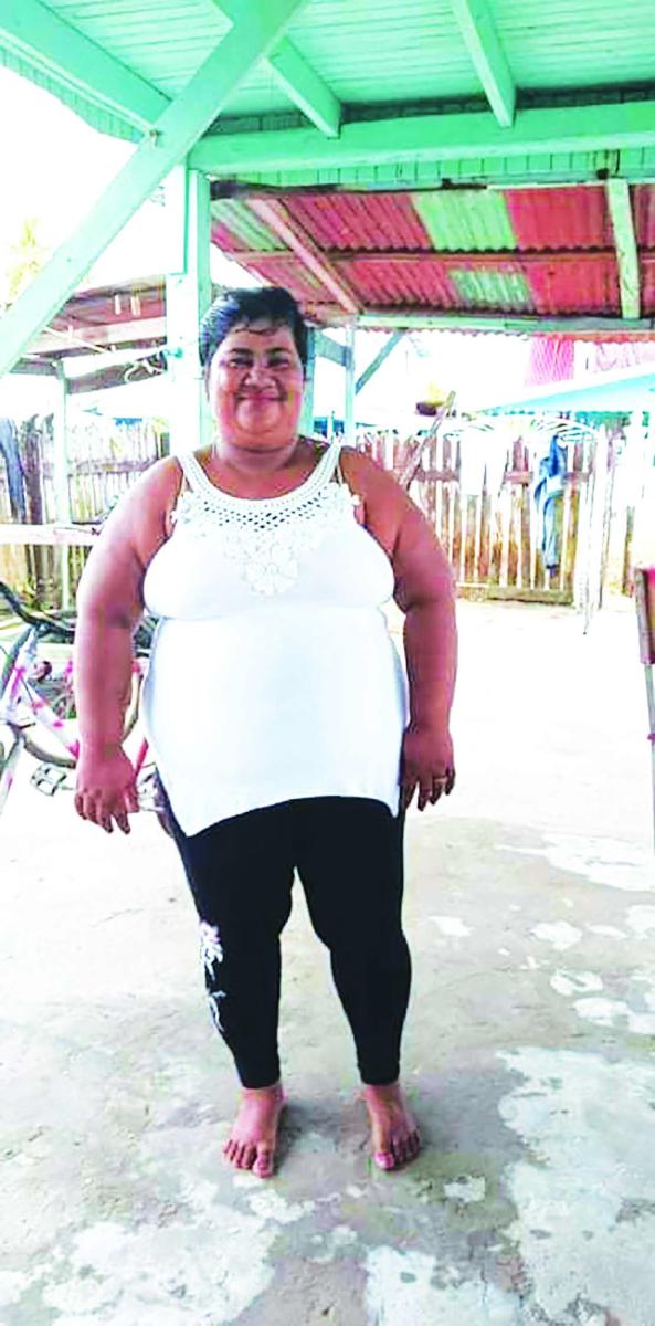 Mother of 4 set on fire by husband - Guyana Times