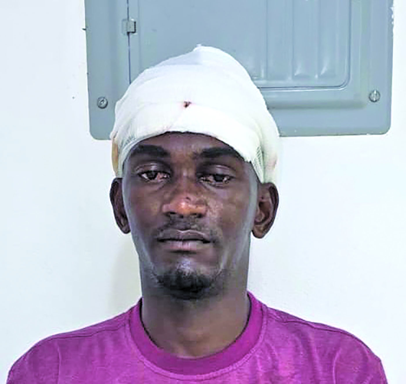 Cattle ranger remanded for attempted murder of Corentyne man